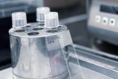 Fertiliza-10_19_01_2022