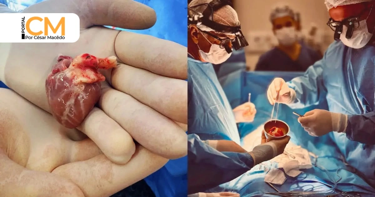 Hospital Universitário do Ceará realiza dois primeiros transplantes cardíacos pediátricos